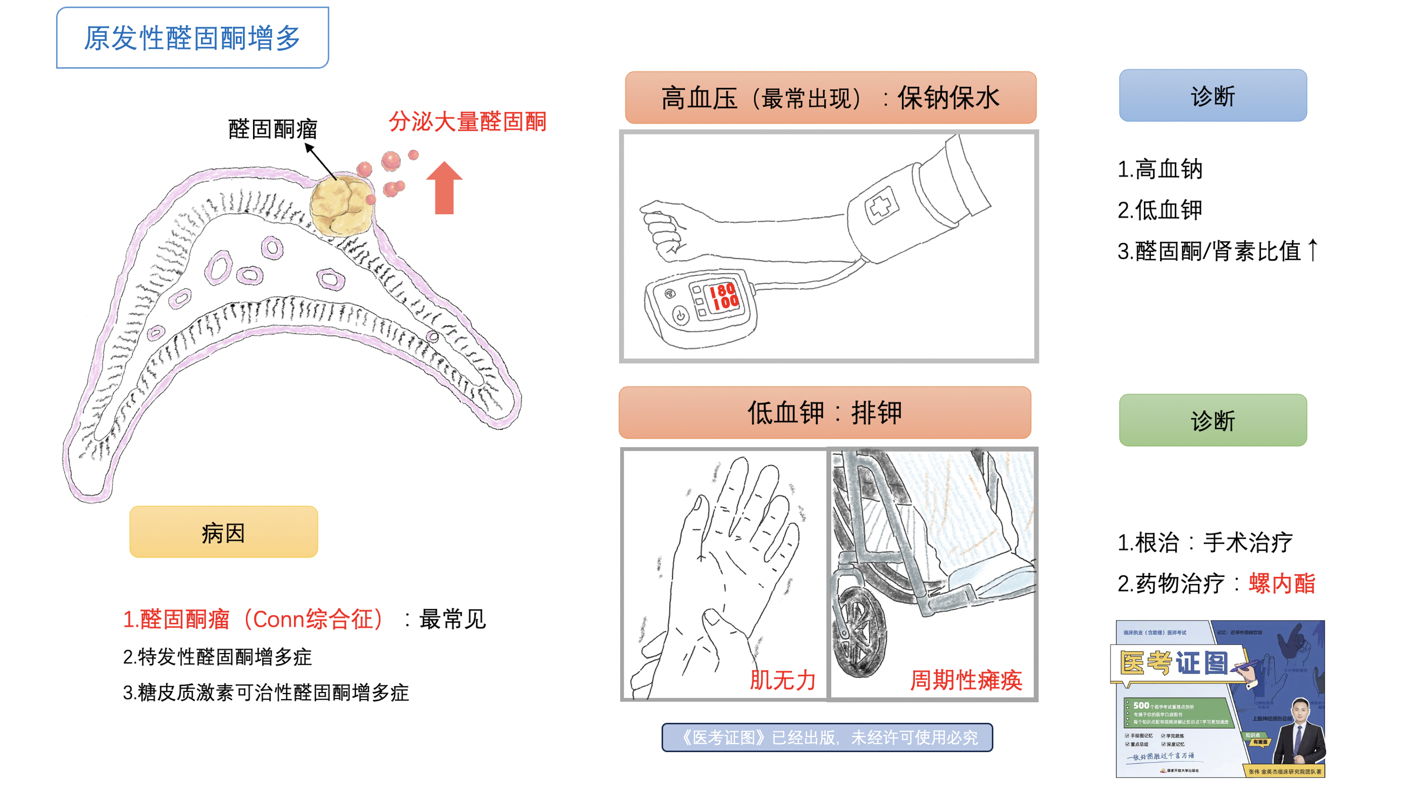 原发性醛固酮增多.png